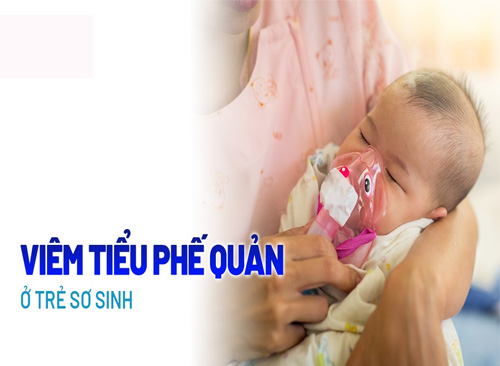 Bệnh Viêm Tiểu Phế Quản Ở Trẻ Sơ Sinh Và 3 Nguyên Tắc Mẹ Cần Biết