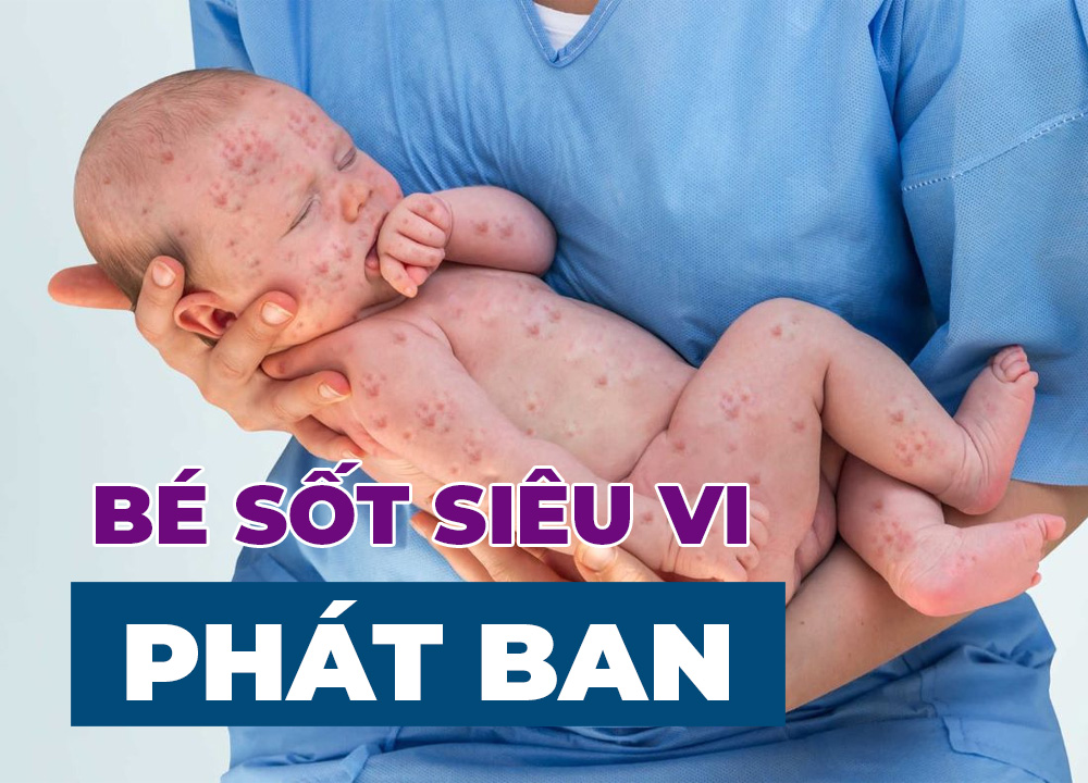 Sốt Siêu Vi Phát Ban Ở Trẻ Em Có Nguy Hiểm Không?