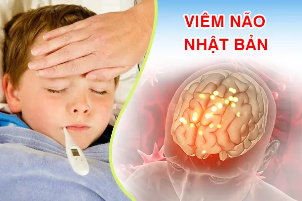Viêm Não Nhật Bản Là Gì? Chích Ngừa Viêm Não Nhật Bản