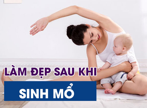 Tuyệt Chiêu Làm Đẹp Sau Sinh Mổ Giúp Mẹ Tự Tin Đầy Sức Sống