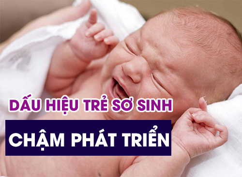 Nhận Diện Các Dấu Hiệu Trẻ Sơ Sinh Chậm Phát Triển
