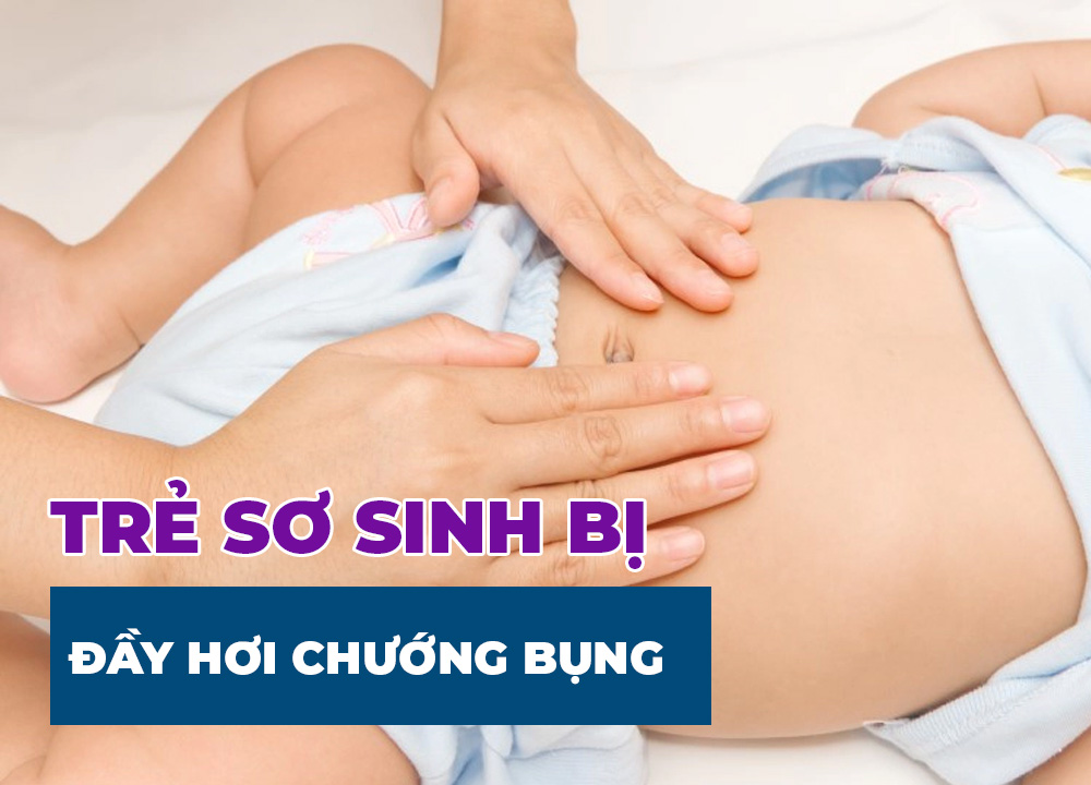 Mách Mẹ Cách Xử Lý Khi Trẻ Sơ Sinh Đầy Hơi Chướng Bụng