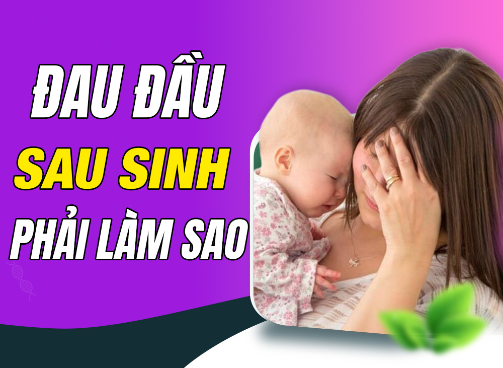 Mẹ Thoát Chứng Đau Đầu Sau Sinh Bằng Cách Tự Nhiên - Dễ Làm Tại Nhà