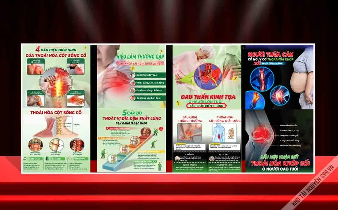 File Corel - Poster Cột sống cổ - Thoái hoá khớp